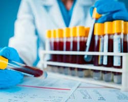 تحليل الحمض النووي في الدم يرسم ملامح العلاج الكيميائي والمناعي للسرطان